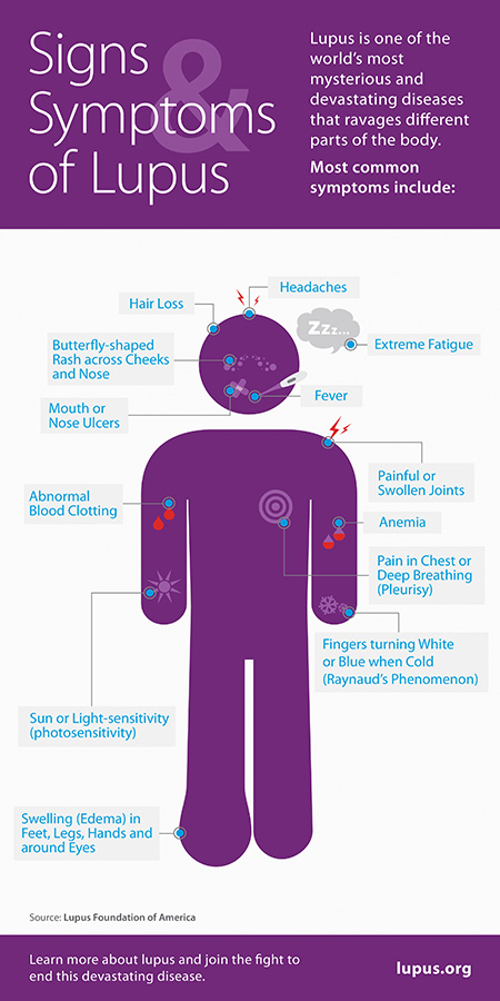 Signs of Lupus