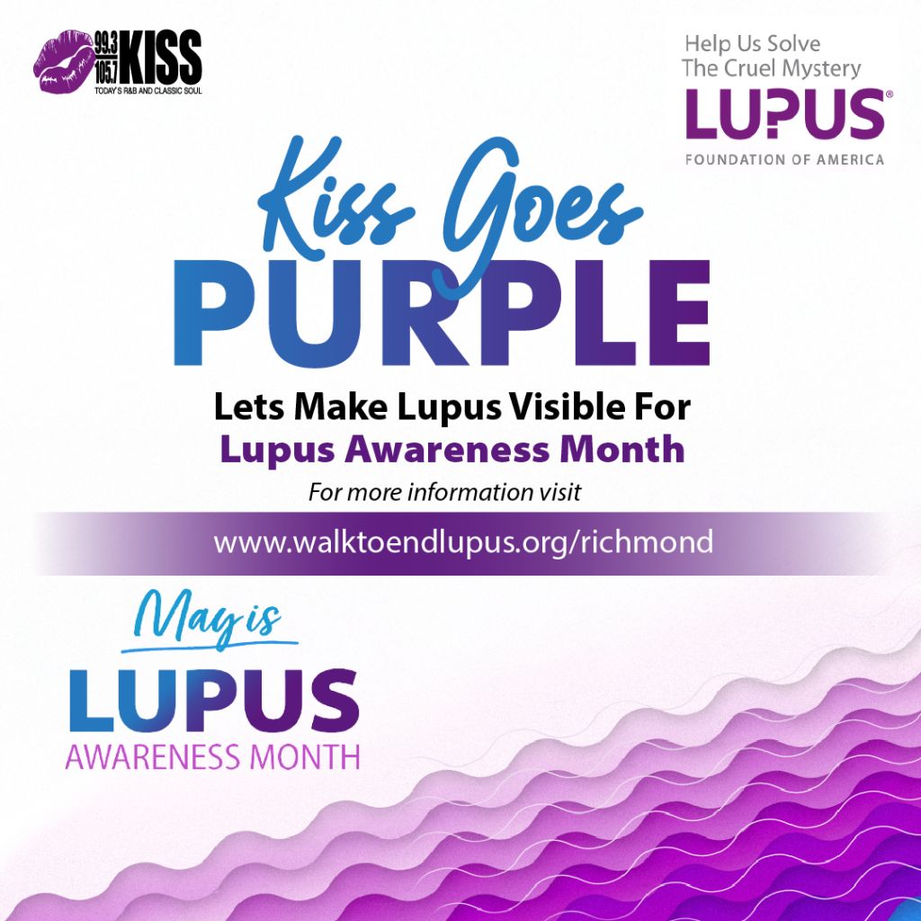Kiss Richmond Lupus Awareness